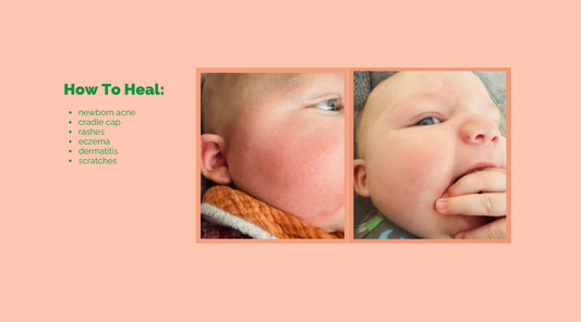 Baby rash before and after healing