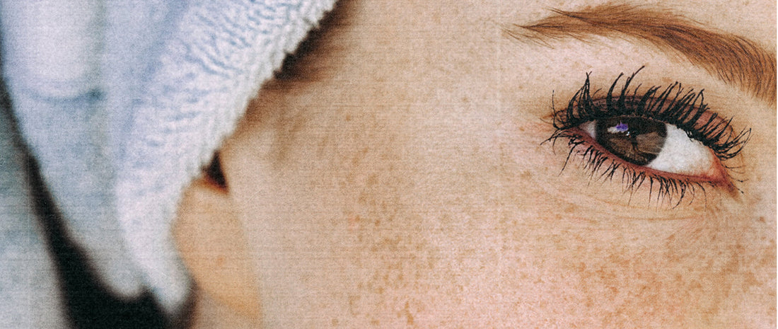 Skin Aging & Dehydration