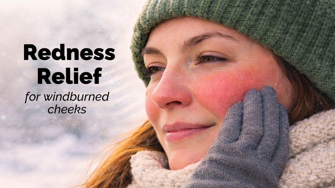 redness relief for windburned cheeks with a closeup of windburned cheeks on a girls fair skinned face