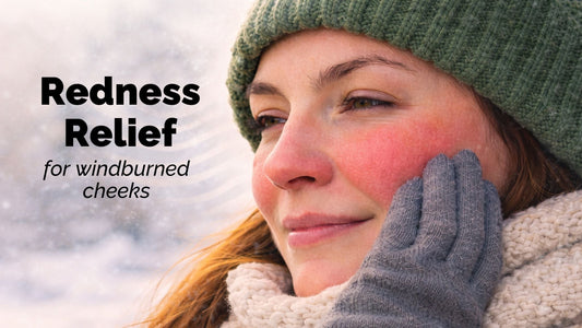 redness relief for windburned cheeks with a closeup of windburned cheeks on a girls fair skinned face